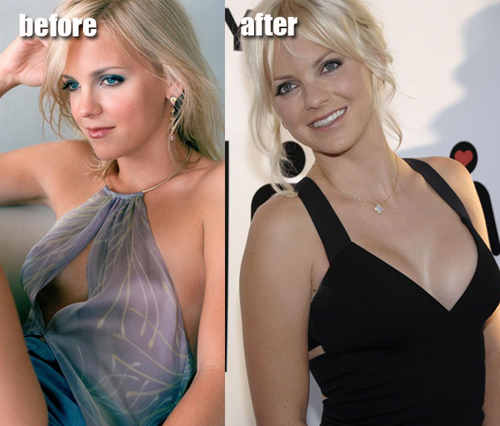 anna faris plastic surgery before after. Faris admits that after having