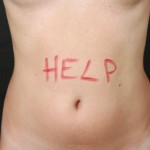 Tummy Tuck Surgeon San Diego