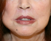 Feel Beautiful - Permanent Lips San Diego - After Photo